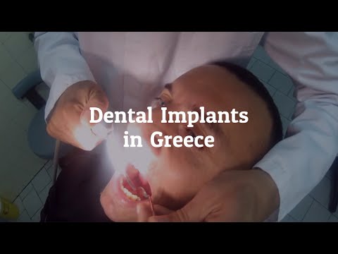 Get All Information on Dental Implants Procedures in Greece