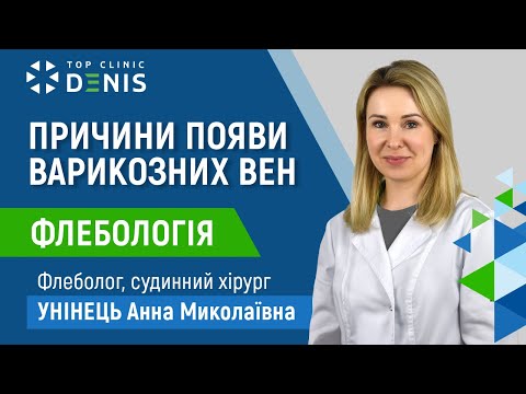 Причины появления варикозных вен - TOP Clinic DENIS