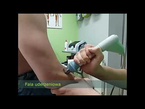 Fala uderzeniowa