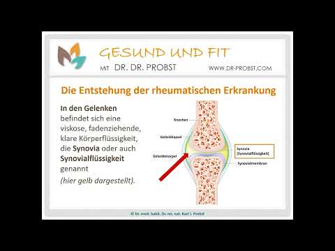 Rheuma natürlich heilen und vorbeugen