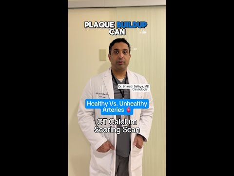 How to Read Your CT Calcium Score