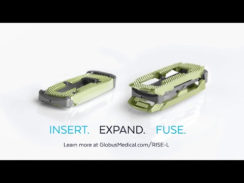 RISE™-L Expandable Lateral Interbody Fusion Spacer