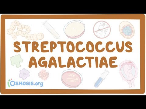 a streptococcus ízületeinek gyulladása folsav ízületi fájdalom
