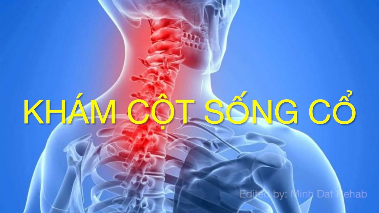 Khám cột sống cổ