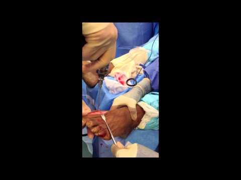 Ask Dr Moore Foot and Ankle FAQ Frequently Asked Questions Video Offering