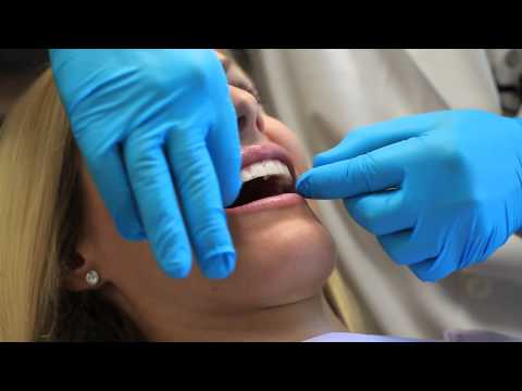 Instructions for Using a Teeth Whitening Strip : Dental Health