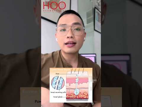 The reason behind overactive sweat glands #shortsfeed #hyperhidrosis #ytshorts #shortsviral