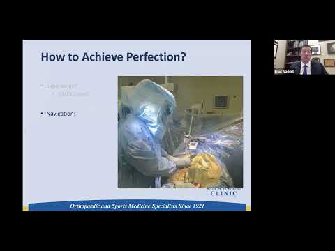 How to Achieve Ideal Stability in THA: A Discussion of Cup Positioning and Joint Offset