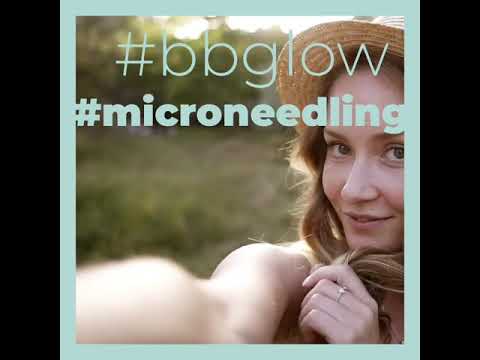 Microneedling & BB Glow Zürich | Praktische Infos zum Thema