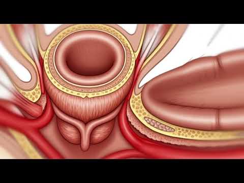 What Happens Inside the Body During Anal Intercourse? | Medical 3D Anatomy Explained Male Pelvic