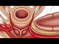 What Happens Inside The Body During Anal Intercourse Medical 3D Anatomy Explained Male Pelvic