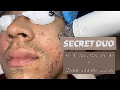 Tratamiento Secret Duo