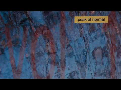 Peak Of Normal - Foam