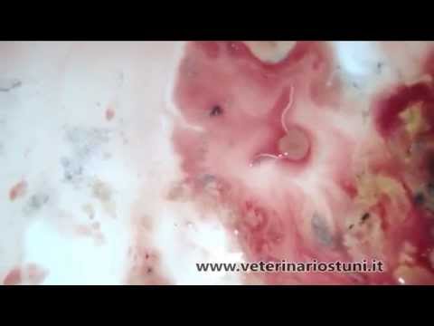 Quello che helminths intestinale può prendere direttamente dalla persona Se è possibile si libererà da fame di parassiti