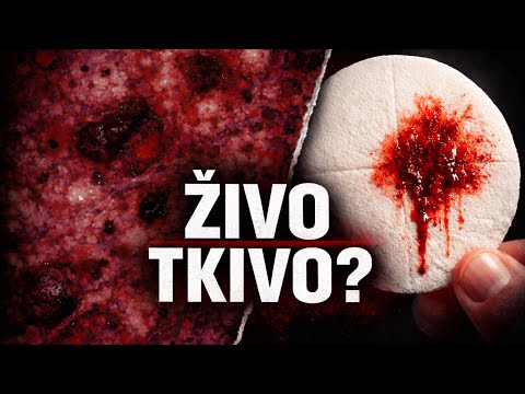 Uzorci iz crkava završili su u laboratorijima: rezultati su šokantni