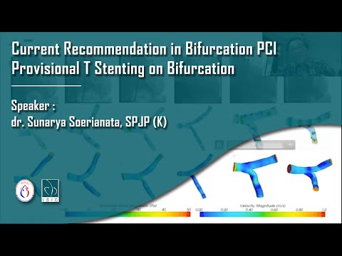 Current Recommendation in Bifurcation PCI Provisional T Stenting on Bifurcation
