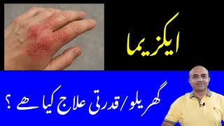 Eczema Kya Hai? Causes, Risk Factors, Flare-Ups, Natural & Medical Treatment | Dr Afzal