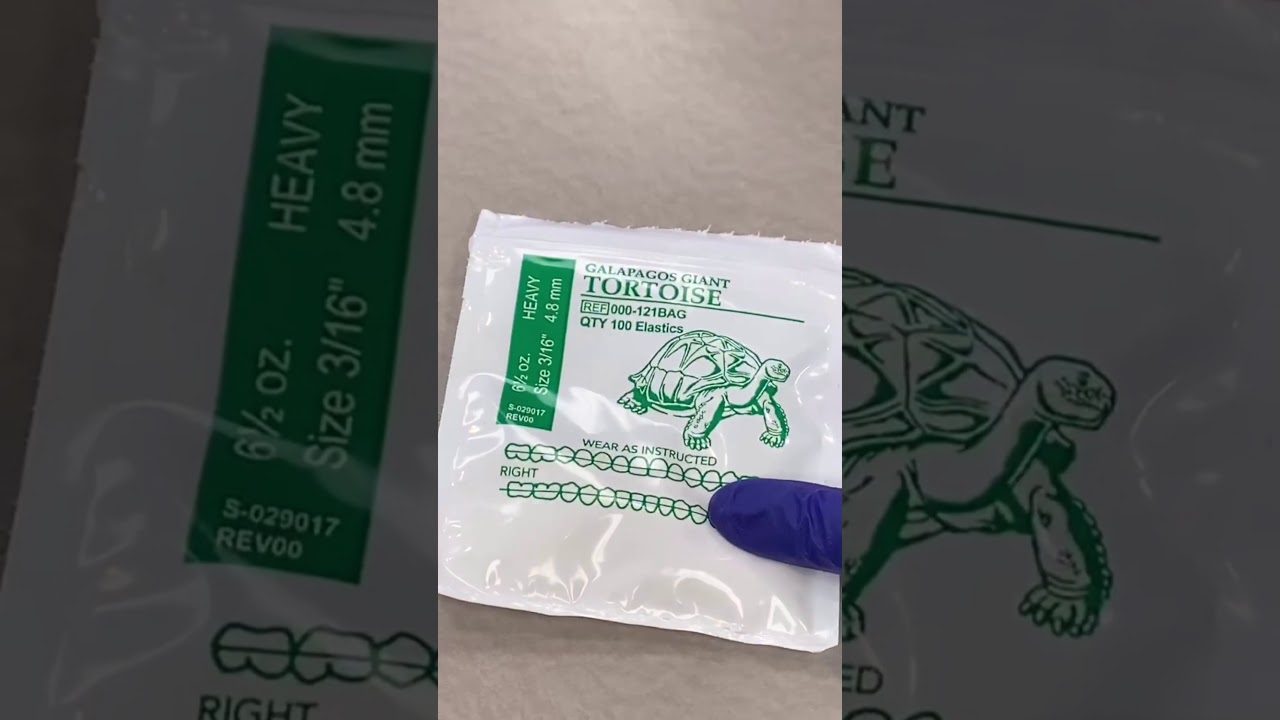 Rubberbands 101: Class II Box