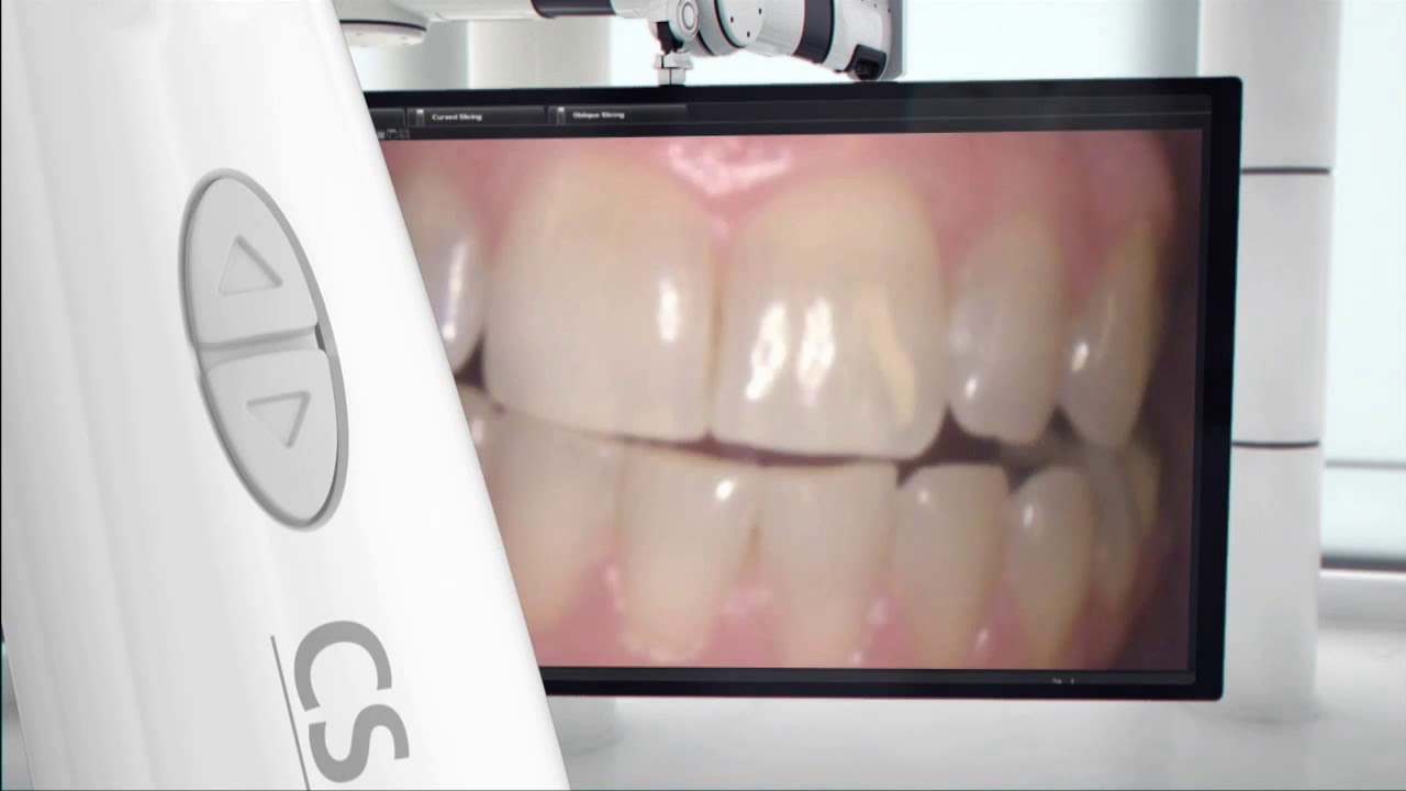 CS 1200 Intra Oral Camera