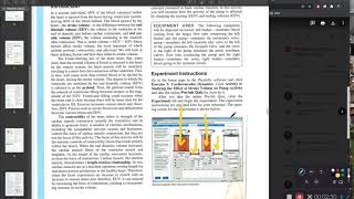 PhysioEx Ex 5 Activity 6