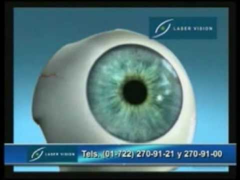 download lagu mp3 mp4 Vejarano Laser Vision, download lagu Vejarano Laser Vision gratis, unduh video klip Vejarano Laser Vision