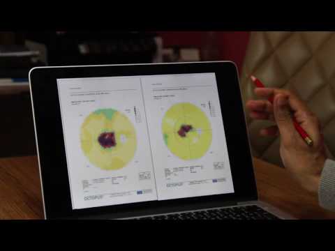 Stargardt Disease Treatment - Patient from Australia- Part 2 - FIRATLI CLINIC