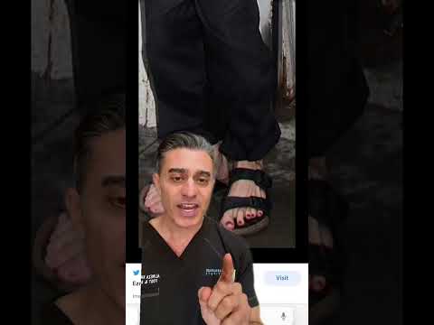Unlocking The Flash's Hidden Foot Conditions