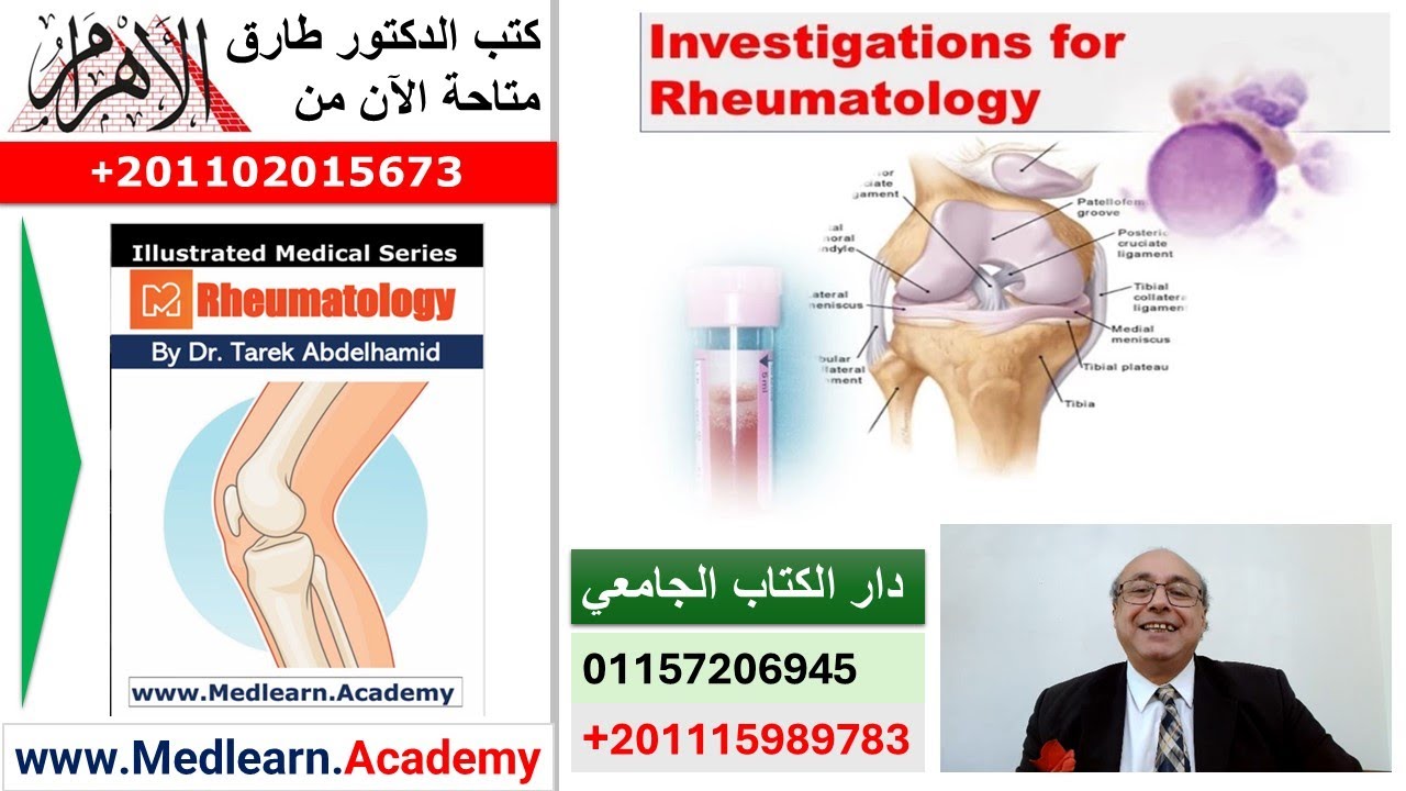 Investigations in Rheumatology #cme #internal_medicine #usmle  #medical #محاضرات_باطنة