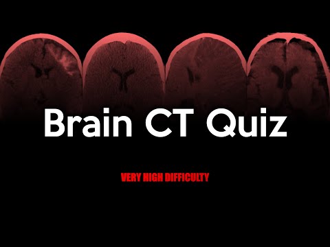 Brain CT Quiz: Very High Difficulty