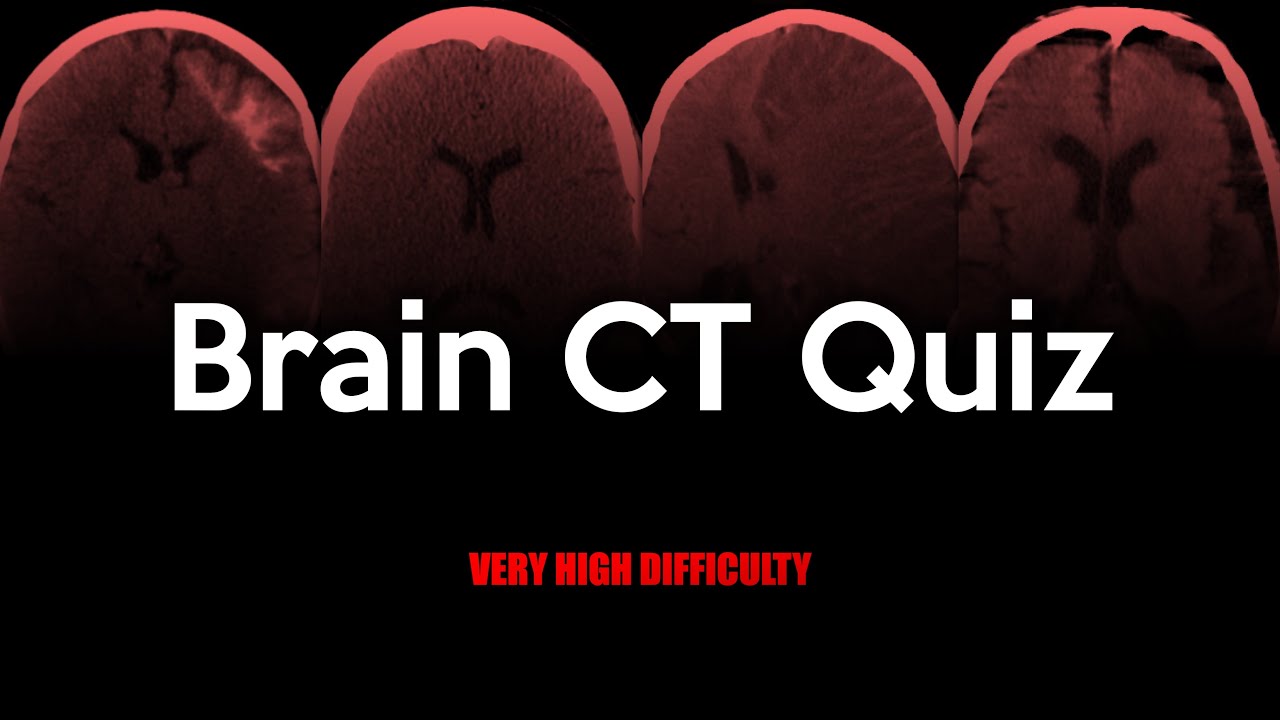 Brain CT Quiz: Very High Difficulty