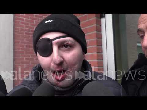 Lo sfregiò con l'acido, Giuseppe, la vittima: "In aula Sara rideva ma avremo giustizia"