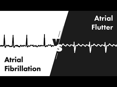 Atrial Fibrillation vs Atrial Flutter - ECG (EKG) Interpretation - MEDZCOOL