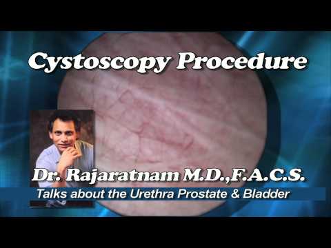 CYSTOSCOPY