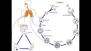 Clinical presentation of Pneumocystis Pneumonia
