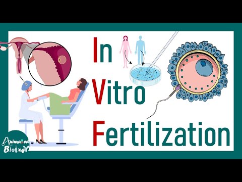 In Vitro fertilization | IVF | Process of in vitro Fertilization | How IVF is performed? |Embryology