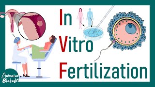 In Vitro fertilization | IVF | Process of in vitro Fertilization | How IVF is performed? |Embryology