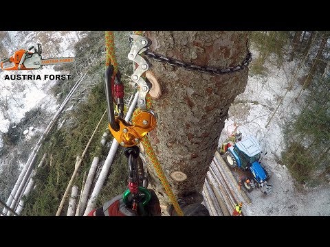 Coxarthrose Betrieb 2 Grad Hüftoperation ohne Gebrochener Knöchel und die Ilizarov-Vorrichtung