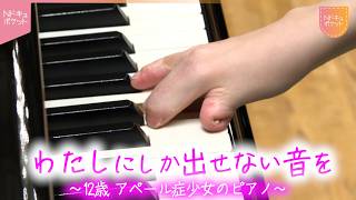 Download lagu 【NNNドキュメント】小さな指で… 難病'アペール症'の少女 ピアノ演奏への情熱とあきらめない心 NNNセレクション mp3 Download lagu 【NNNドキュメント】小さな指で… 難病'アペール症'の少女 ピアノ演奏への情熱とあきらめない心 NNNセレクション mp3