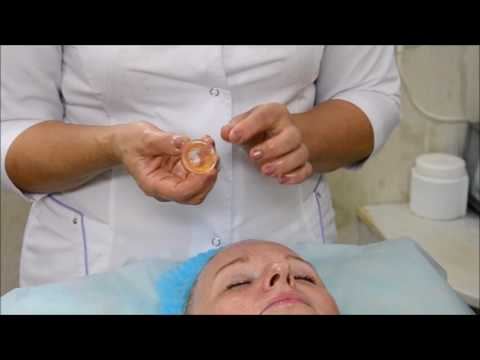 Vakuumna masaža lica: Zona podbratka - YouTube