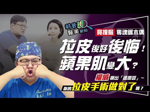 拉皮術後蘋果肌變大 慘變奪魂鋸木偶比利? 拉皮權威揪出一般線雕拉提、拉皮手術弊端