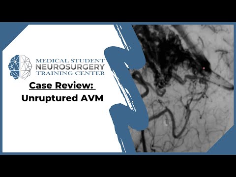 Case Review: Unruptured AVM