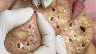 𝘚ℎ𝘢𝑟𝘦 𝘵𝑖𝘱𝑠 𝑓𝘰𝑟 𝑐𝘭𝑒𝘢𝑛𝘪𝑛𝘨 𝘢𝑛𝘥 𝘵𝑎𝘬𝑖𝘯𝑔 𝑐𝘢𝑟𝘦 𝘰𝑓 𝑦𝘰𝑢𝘳 𝘧𝑎𝘤𝑒 #35