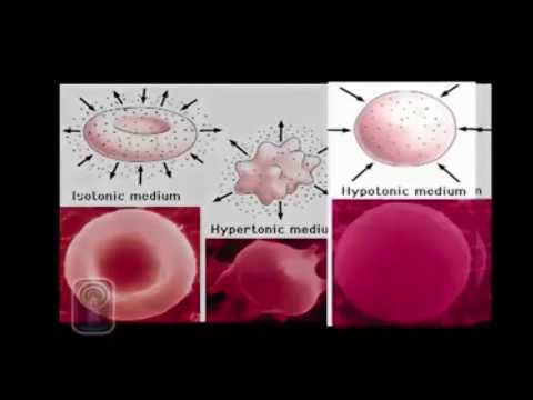 OSMOSI E GLOBULI ROSSI