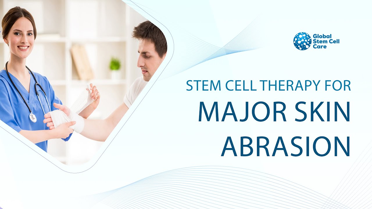 Stem Cell Treatment for Major Skin Abrasion | Treatment for Major Skin Abrasion | Stem Cell Therapy