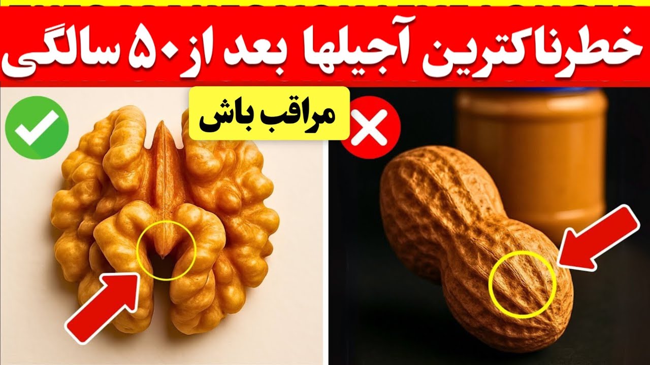 ۴ آجیل که باید ازشون پرهیز کنی و ۴ آجیل که عمرتو طولانی می‌کنن