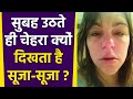 सुबह उठतेे ही चेहरे पर दिखती है सूजन ज�