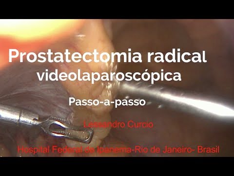 Urologico Vibro per la prostata Rettale della prostata