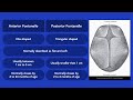 Fontanelles - Medical Education for Visual Learners Fontanelles