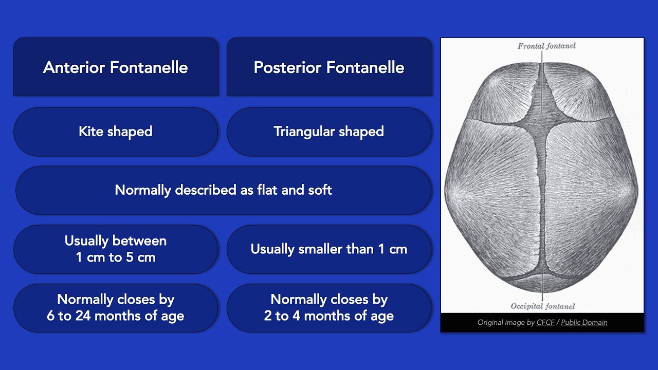 What is delayed fontanel closure? Tipseri