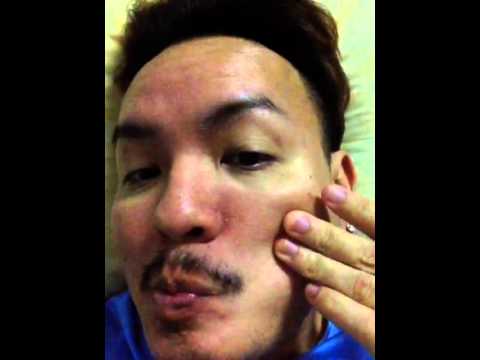 ขี้ผึ้งบางส่วนสามารถใช้กับ neurodermatitis ซื้อยาจีนสำหรับโรคสะเก็ดเงิน
